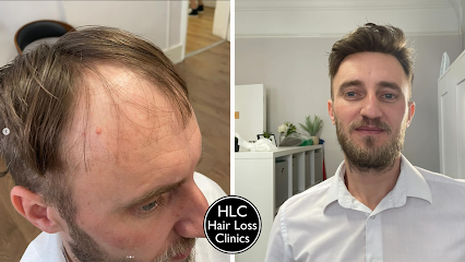 Cardiff Hair Loss Clinic